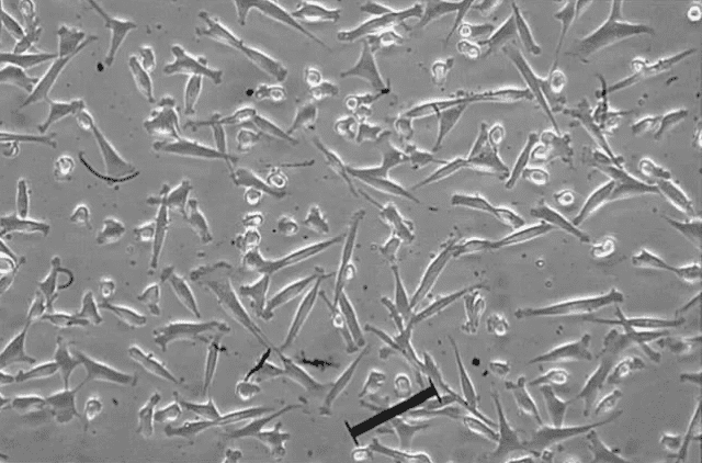 告訴你間充質干細胞為什么能得到臨床研究的“偏愛”