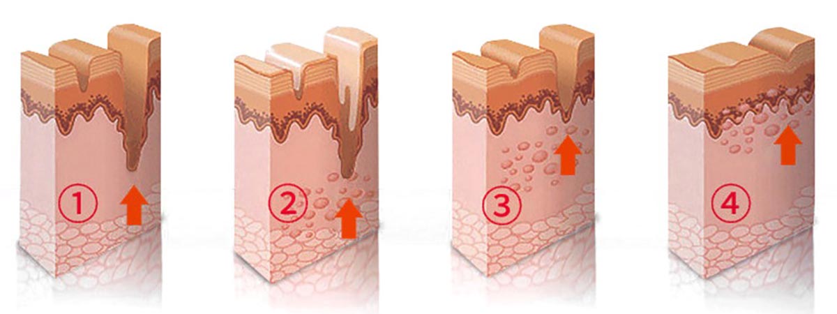 1685695948114725.jpg yinzizuoyong.jpg