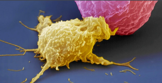 研究發現輸注NK細胞后，身體會逐步發生的10大變化